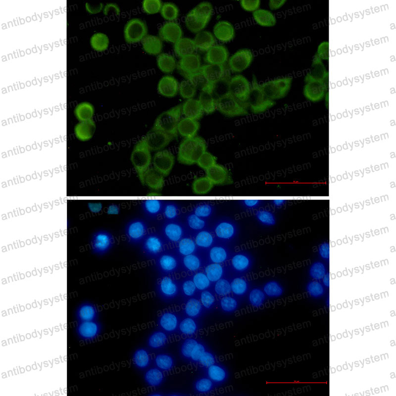 Anti-YBX1 Antibody (R2A77)