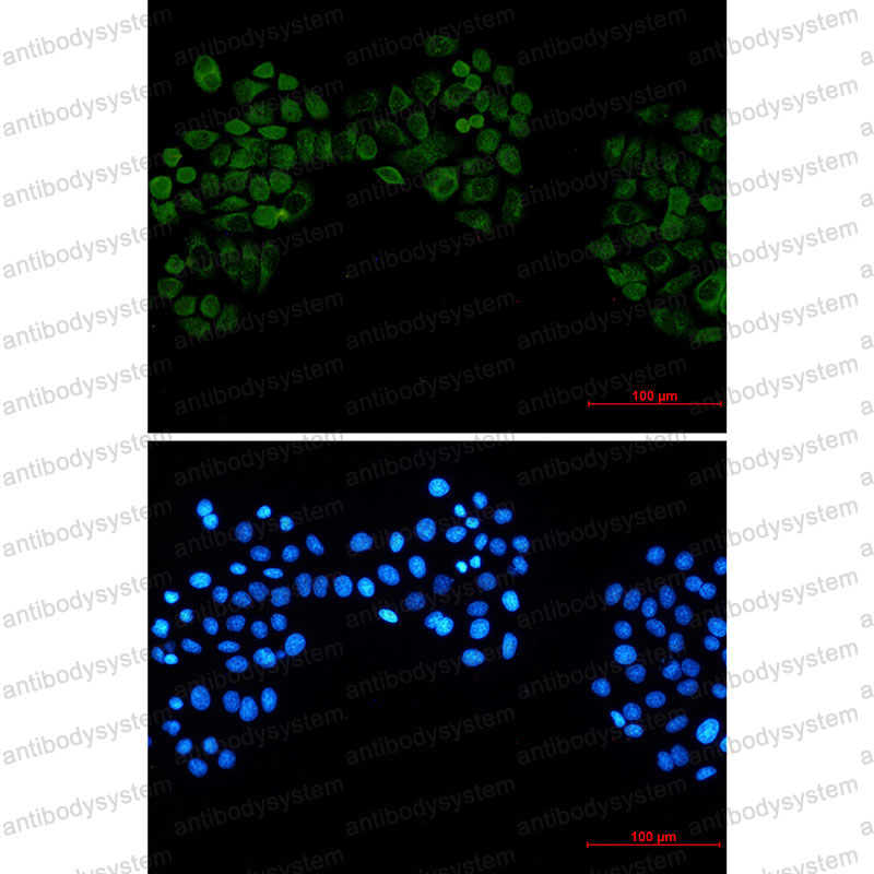 Anti-CSNK2B Antibody (R2A78)