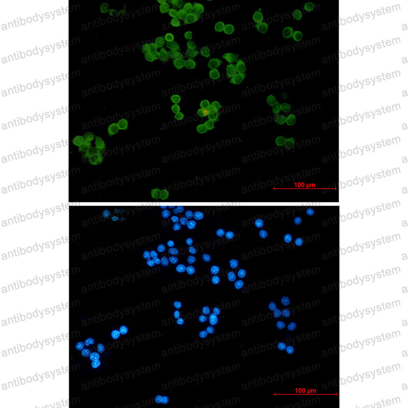 Anti-UBE2L3 Antibody (R2A80)