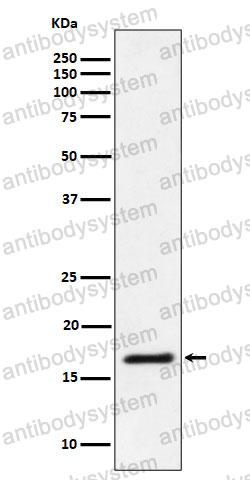 Anti-Ube2L3/UBCH7 Antibody (R2A79)