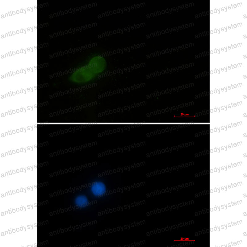 Anti-EEF1A1 Antibody (R2A83)