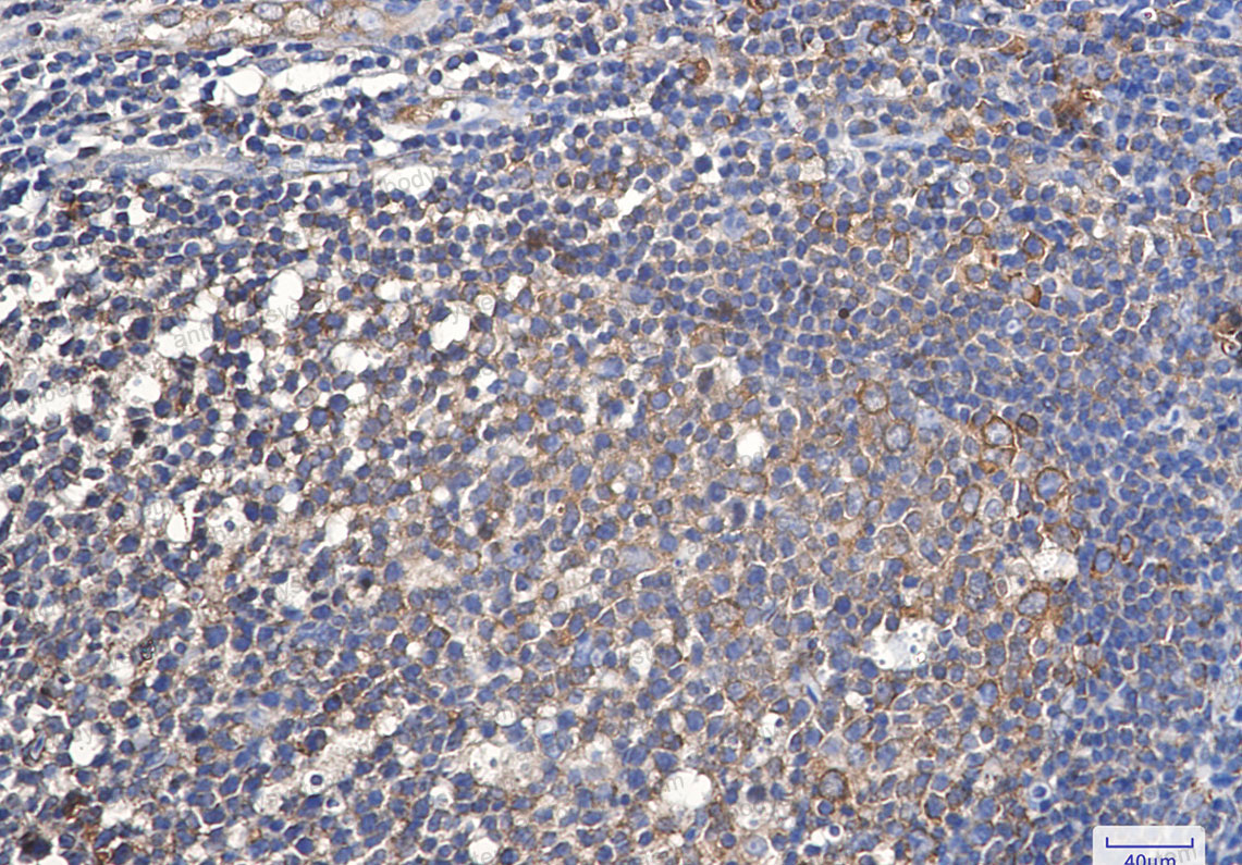 Anti-EEF1A1 Antibody (R2A82)