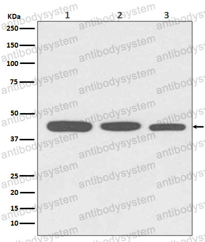 Anti-ACTA1 Antibody (R2A84)
