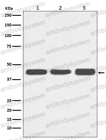 Anti-ACTA1 Antibody (R2A85)