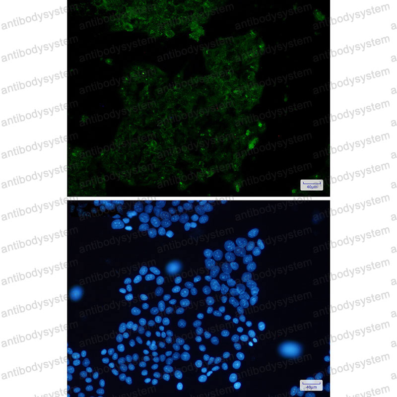 Anti-ACTA1 Antibody (R2A87)
