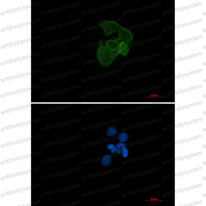 Anti-ACTA1 Antibody (R2A88)