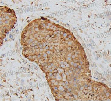 Anti-Alpha Tubulin Antibody (R3P38)