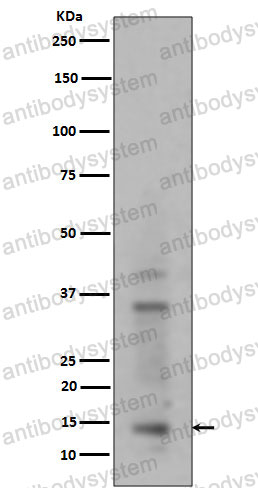 Anti-Histone H3 (mono/di/trimethyl K14) Antibody (R1C21)