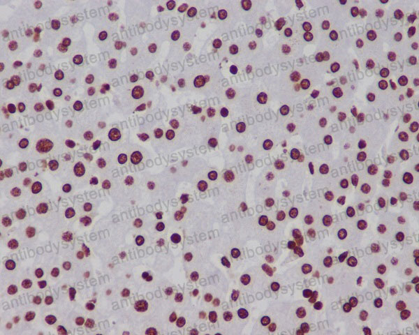 Anti-Histone H3 (monomethyl K18) Antibody (R1C11)