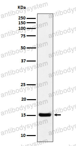 Anti-Histone H3 (acetyl K36) Antibody (R2A92)