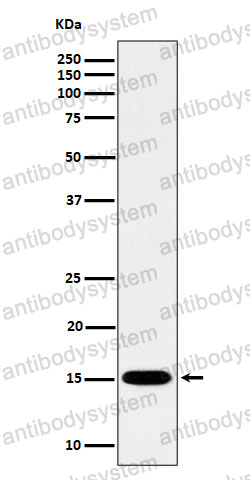 Anti-Histone H3 (monomethyl K79) Antibody (R2A93)