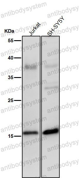 Anti-Phospho-Histone H3 (S28) Antibody (R2A97)