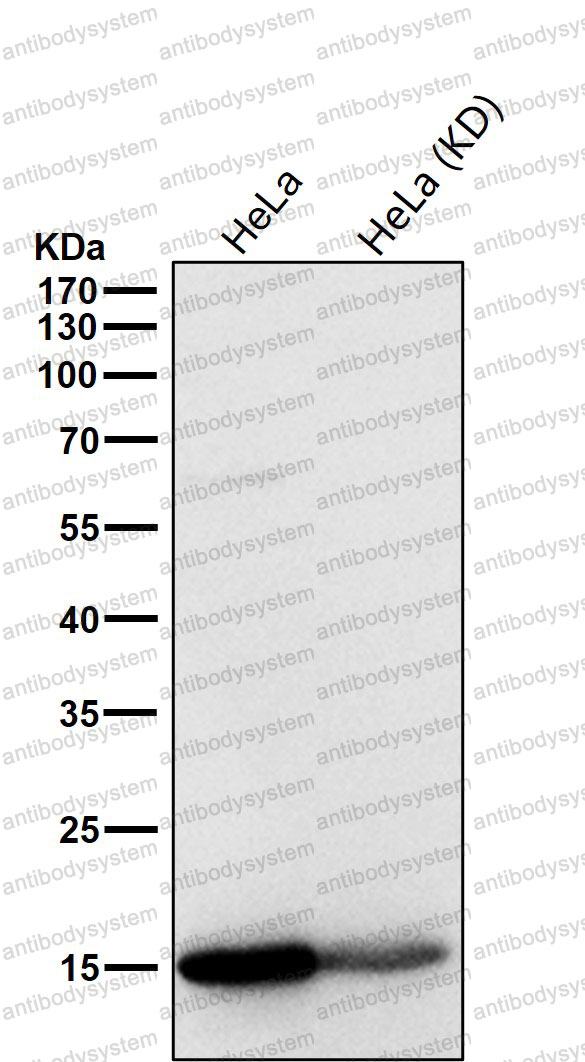 Anti-Histone H3 (acetyl K9) Antibody (R2A98)