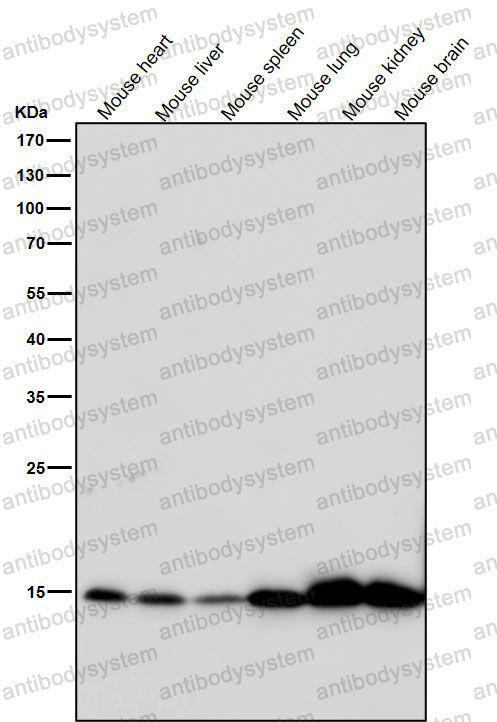 Anti-Histone H3 (acetyl K9) Antibody (R2A99)