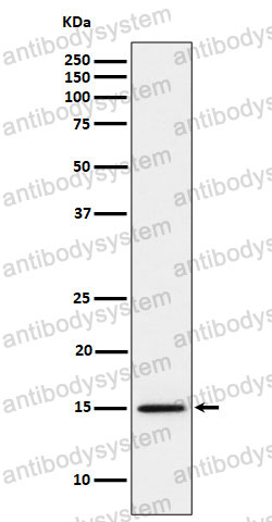 Anti-Histone H3 (monomethyl K14) Antibody (R2B02)