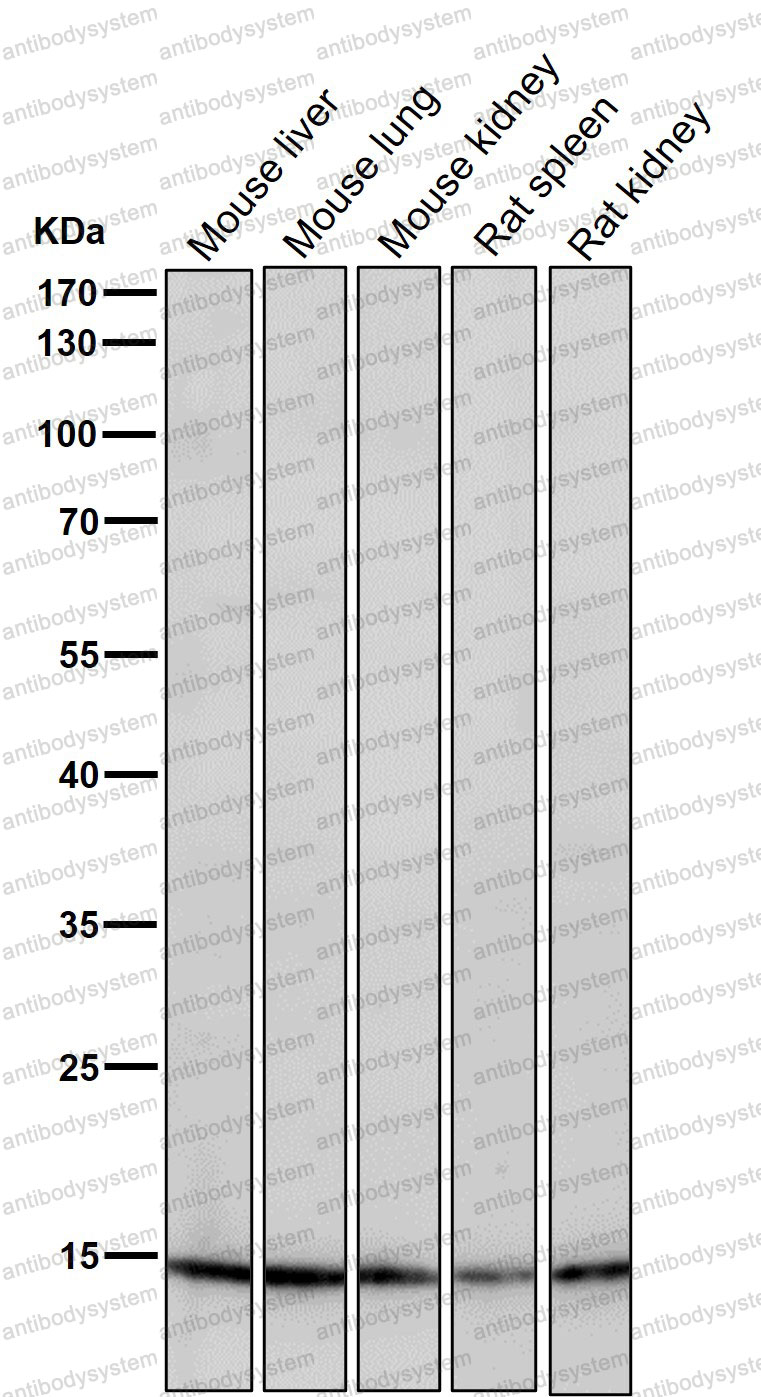 Anti-Histone H3 (acetyl K23) Antibody (R2B06)