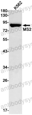 Western blot for Anti-CD156a/ADAM8 Antibody (R2B24) ?>