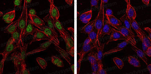 Immunofluorescence for Anti-CCT2 Antibody (R3P73) ?>
