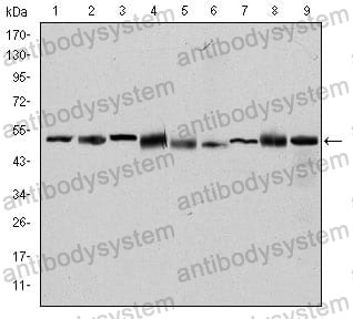 Western blot for Anti-CCT2 Antibody (R3P73) ?>