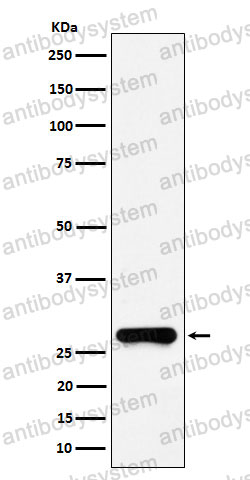 Anti-GSTO1 Antibody (R2B31)