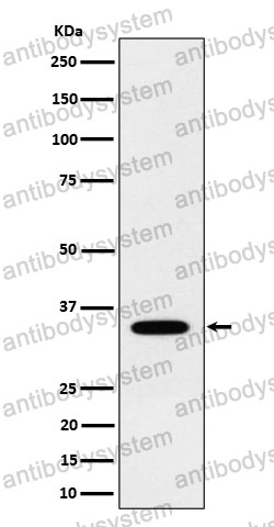 Anti-NTHL1 Antibody (R2B35)