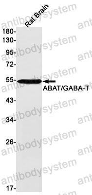 Anti-ABAT Antibody (R2B41)