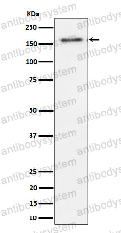 Anti-TMF1 Antibody (R1A89)