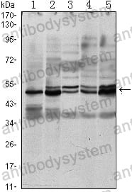 Western blot for Anti-SMAD3 Antibody (R3P94) ?>