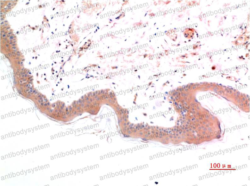 Immunohistochemical for Anti-Phospho-Smad3 (Ser425) Antibody (R3P95) ?>