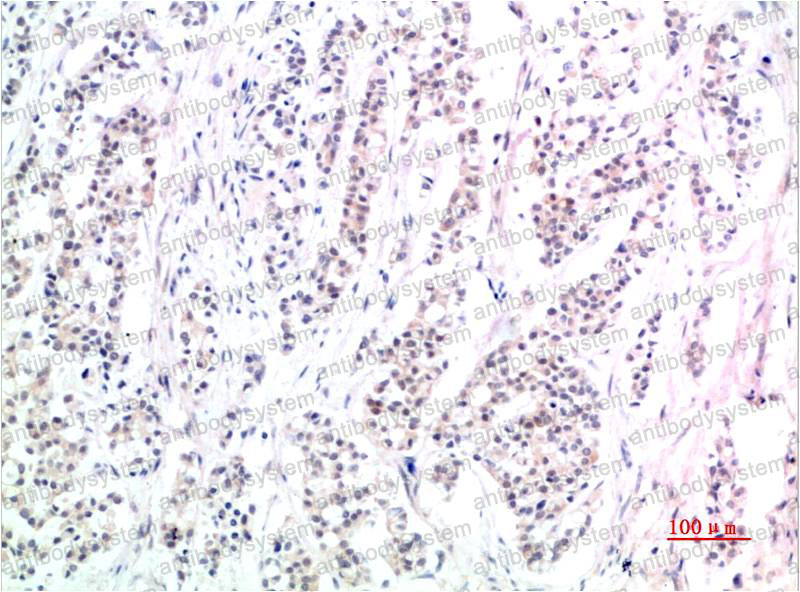 Immunohistochemical for Anti-Phospho-Smad3 (Ser425) Antibody (R3P95) ?>