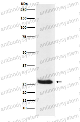 Anti-HPCA Antibody (R2B48)