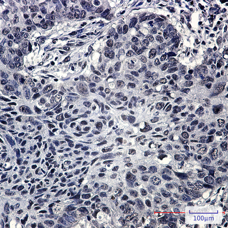 Anti-SRSF3 Antibody (R2B51)