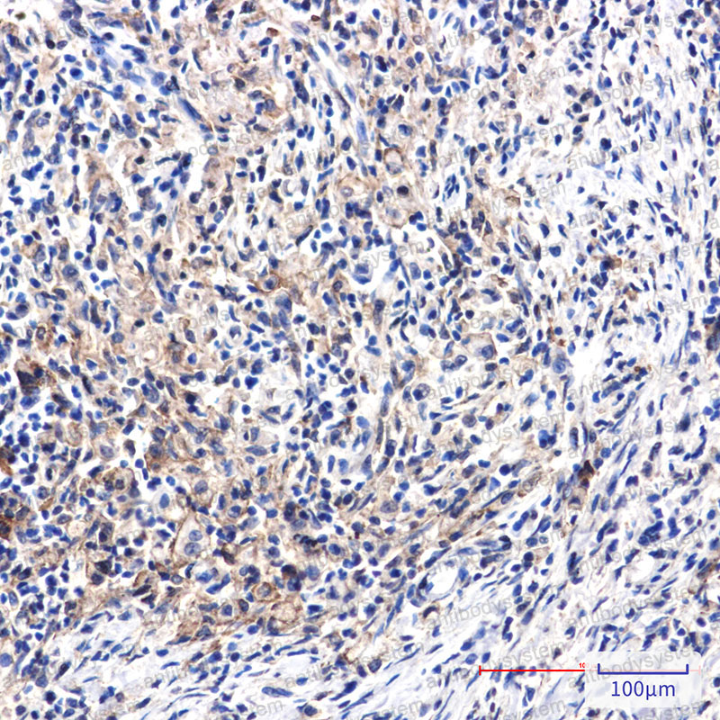Anti-DAB2 Antibody (R2B53)