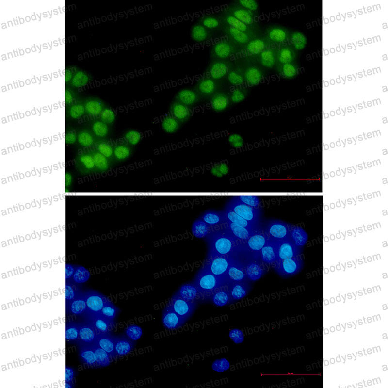 Anti-RBM3 Antibody (R2B60)