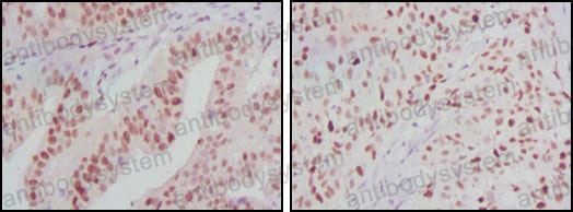 Immunohistochemical for Anti-ATP2C1 Antibody (R3Q08) ?>
