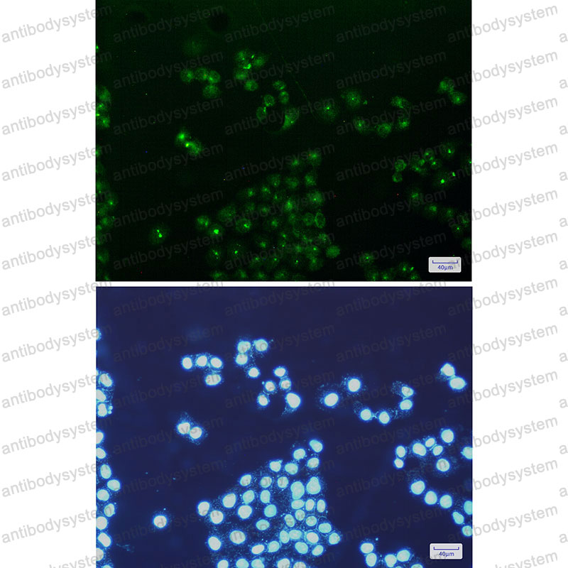 Anti-TFAM Antibody (R2B66)