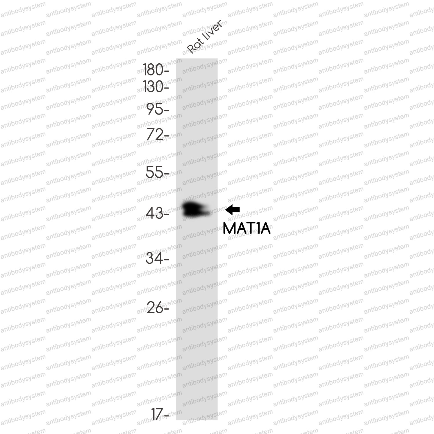 Anti-MAT1A Antibody (R2B67)