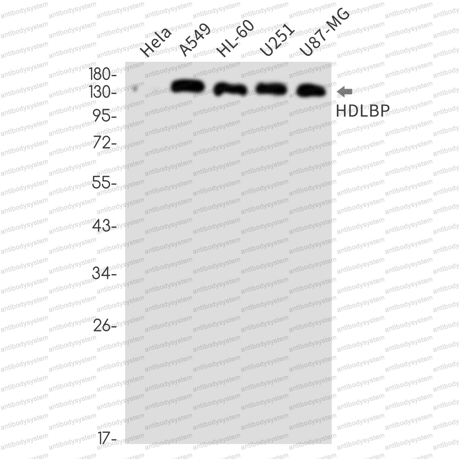 Anti-HDLBP Antibody (R2B70)