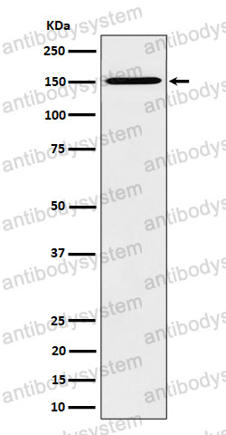 Anti-HDLBP Antibody (R2B68)