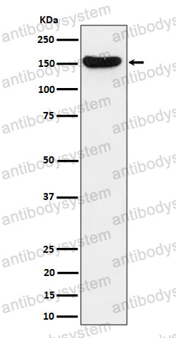 Anti-HDLBP Antibody (R2B69)