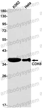 Anti-CDK6 Antibody (R2B73)