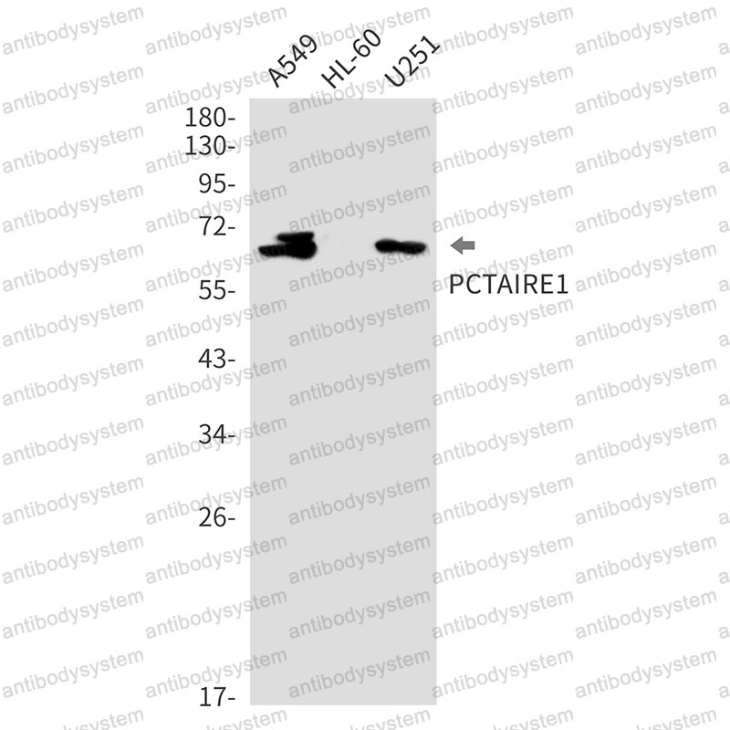 Anti-CDK16 Antibody (R2B75)