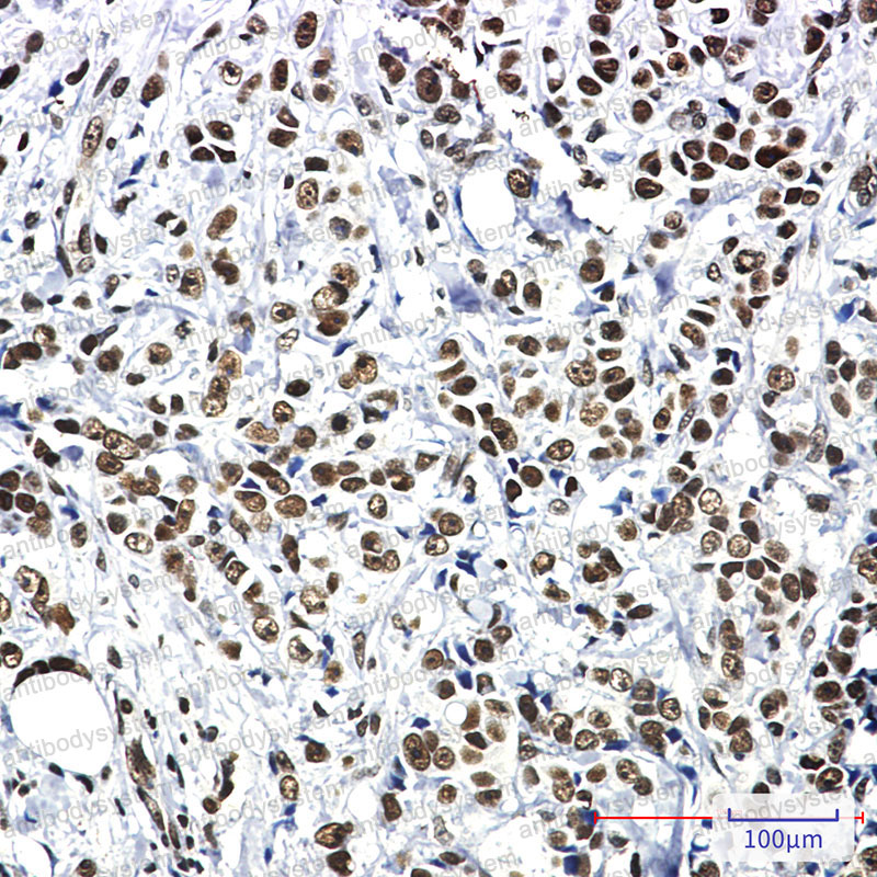 Anti-HSF1 Antibody (R2B81)
