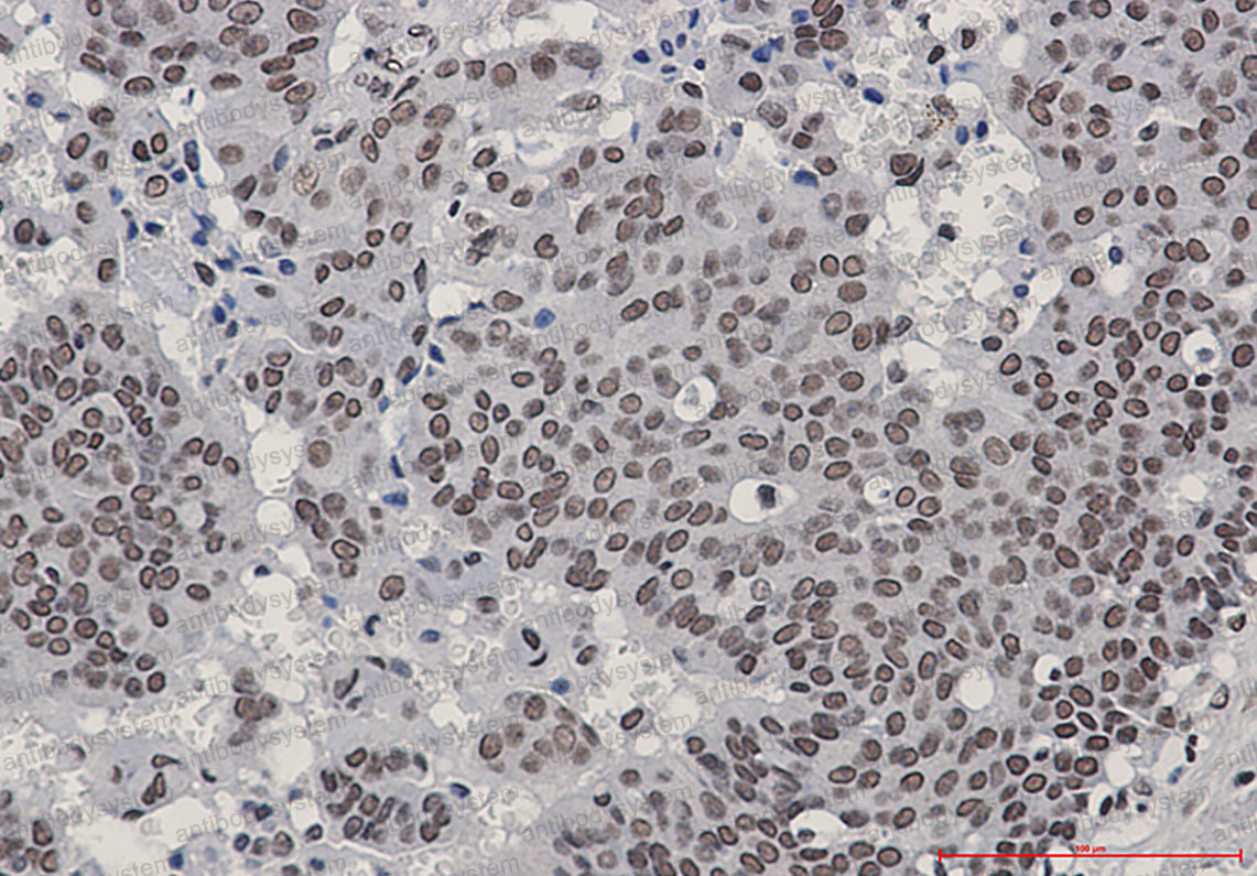 Anti-Phospho-HSF1 (Ser303/Ser307) Antibody (R2B80)