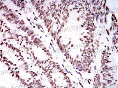 Immunohistochemical for Anti-HNRNPU Antibody (R3Q21) ?>