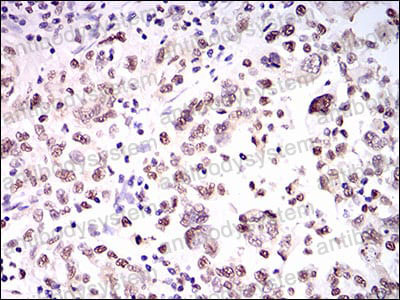 Immunohistochemical for Anti-HNRNPU Antibody (R3Q21) ?>
