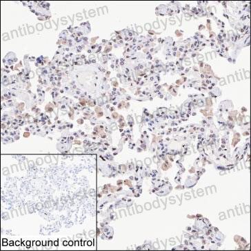 Anti-IRF9 Antibody (R3Q23)