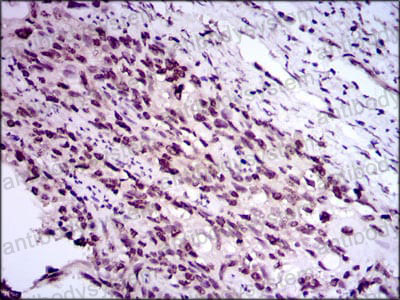 Immunohistochemical for Anti-E2F1/RBBP3 Antibody (R3Q30) ?>