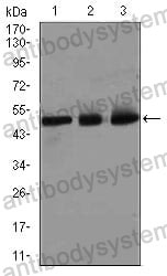 Western blot for Anti-E2F1/RBBP3 Antibody (R3Q30) ?>