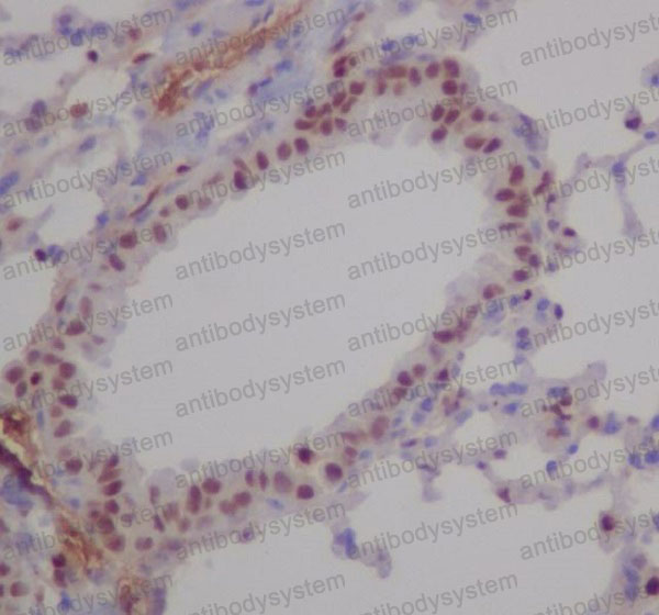 Anti-RUNX1/RUNX2/RUNX3 Antibody (R1B52)
